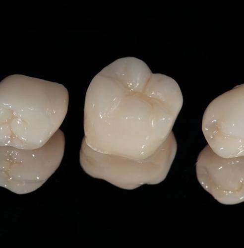 Dental crowns