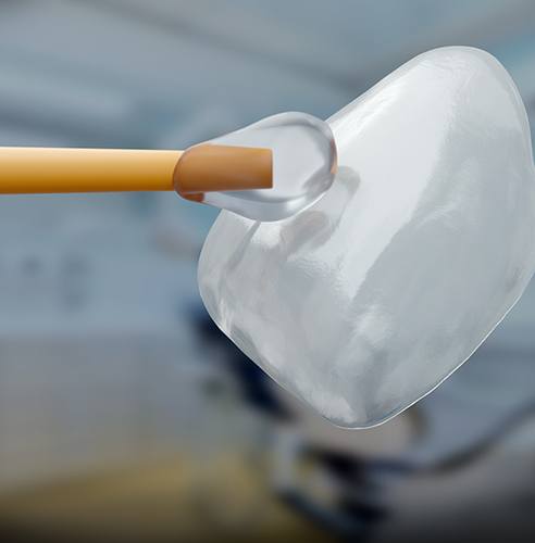 Applying clear liquid to veneer in Pasadena