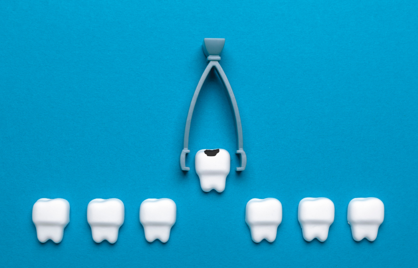 Ceramic teeth with forceps
